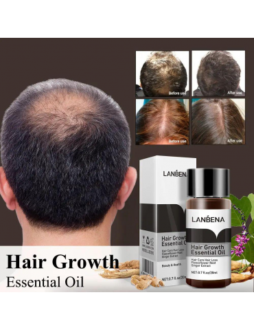 Есенція для росту волосся Lanbena Hair Growth Essential Oil 20 ml